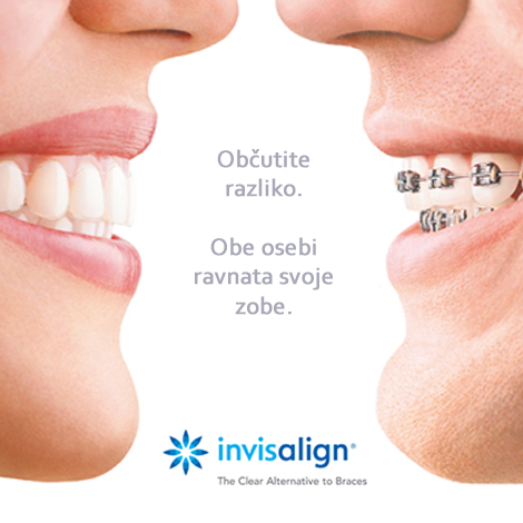 INVISALIGN - nevidni zobni aparati