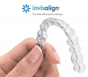 INVISALIGN - nevidni zobni aparat