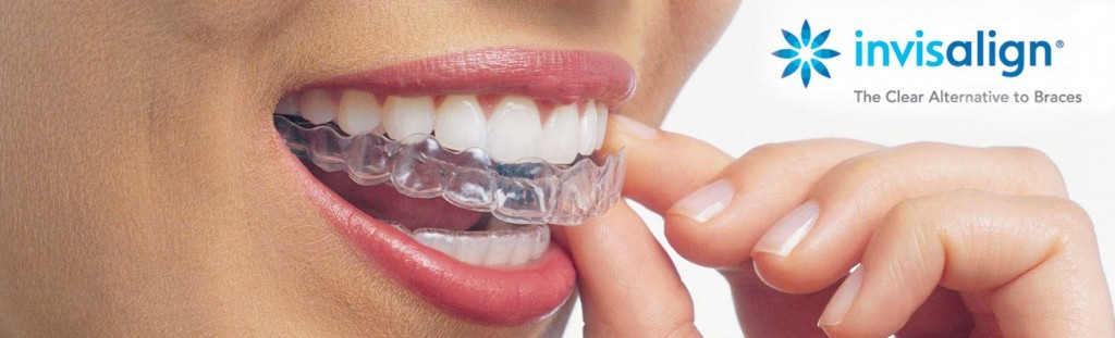 Inovacija v ortodontiji. Neopazen aparat za ravnanje vaših zob.
Več informacij...